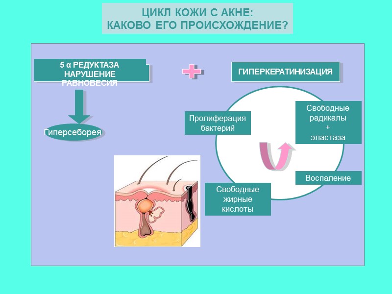 ЦИКЛ КОЖИ С АКНЕ:  КАКОВО ЕГО ПРОИСХОЖДЕНИЕ?